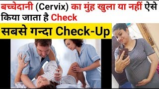 बच्चेदानी Cervix का मुंह खुला या नहीं ऐसे किया जाता है Check  Doctor Checks Cervix in Pregnancy [upl. by Jocelyne]