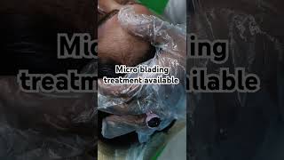 micro blading treatment [upl. by Kenrick]