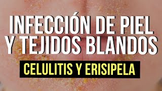 Infección de piel y tejidos blandos 🦠  Celulitis y Erisipela [upl. by Ecnerrot]