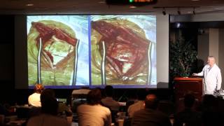 Designing a Lateral Skull Base Approach [upl. by Ainoz]