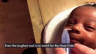 NoseFrida How it Works amp Demonstration with a Baby [upl. by Ardnuhsed]