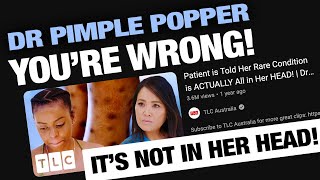 Calling Out Dr Pimple Popper  Mysterious Rash Prurigo Nodularis [upl. by Glynda]