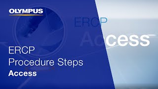 ERCP Procedure Steps I Access [upl. by Stryker]