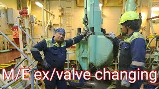 ME exvalve changing [upl. by Niala]