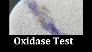 Oxidase test Protocol [upl. by Hunfredo]