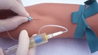 Performing a venipuncture using a butterfly needle [upl. by Laven]