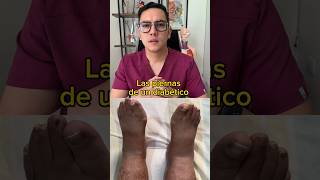 Así son las piernas de un diabéticoa  Dr William Guerrero medicina shorts [upl. by Dyl]