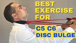 Best Exercises For C5 C6 Bulging Disc  C5 C6 Herniated Disc Exercises by Dr Walter Salubro [upl. by Rehpotsihc]