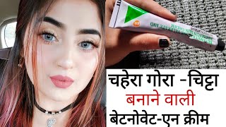 Betnovate N Cream Complete Review हिन्दी मैं Betnovate N Cream Uses amp Side effects [upl. by Trebma]