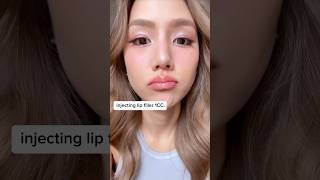 Review of injecting lip filler myself with 1CC [upl. by Yadseut]