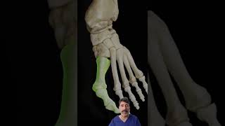 ¿Que es un JUANETE o HALLUX VALGUS dolor fisiolution juanetes dolorpies [upl. by Imuy]