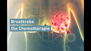 Brustkrebs Die Chemotherapie [upl. by Filide946]