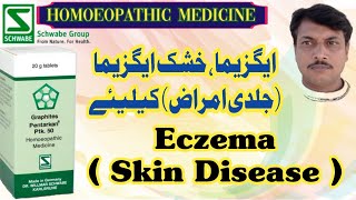 PTK 50 Graphites Pentarkan  DrWillmar Schwabe Germany  Homoeopathic Medicine  Urdu Hindi [upl. by Caddric]