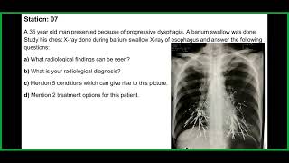 FCPS Mid Term Medicine Last Session BCPS OSCE Solve July24 [upl. by Alduino74]