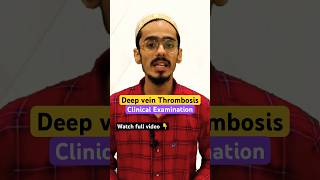 Deep vein thrombosis clinical examination shorts deepveinthrombosis dvt [upl. by Chrysa588]