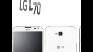 LG L70 MS323 First Steps To Flash Remake 10B ONLY [upl. by Busey299]