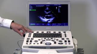 ACUSON Bonsai™ Ultrasound System 2D Optimization [upl. by Fenella588]