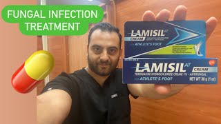 5 top antifungal cream best cream for antifungal infection watch this video for details [upl. by Mia184]