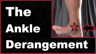 The Ankle Derangement [upl. by Post]