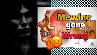 ⚠️ These Mewing Mistakes Will PERMANENTLY Distroy Your Face  Shortly Explained  No bs Guide [upl. by Latreshia]