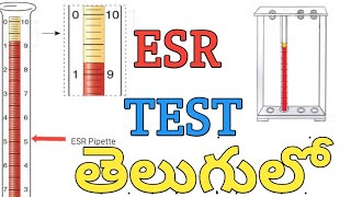 ESR Test procedureIn Teluguerythrocyte sedimentation rate [upl. by Assiroc]