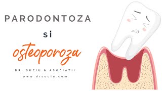 LEGATURA DINTRE OSTEOPOROZA SI PARODONTOZA DR LILIANA SUCIU [upl. by Jocelin893]