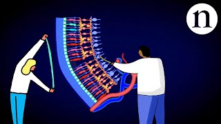 Retinal repair Bringing stem cells into focus [upl. by Carmina]