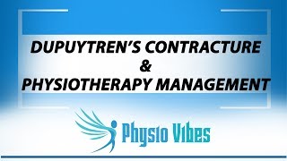 DUPUYTRENS CONTRACTURE amp PHYSIOTHERAPY MANAGEMENT [upl. by Megargee]