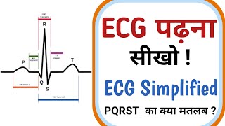 ecg reading in hindi  how to check ecg report in hindi  Electrocardiogram [upl. by Halihs]