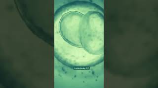 Journey of IVF Embryo Development ivf ivfjourney ivfsuccess [upl. by Ryle509]