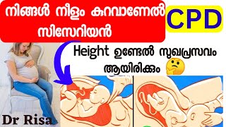 Reason For Cesarean MalayalamCPD In Pregnancy Height Affect Delivery [upl. by Akitnahs]