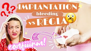 IMPLANTATION BLEEDING VS PERIOD 6 NA PAGKAKAIBA  Nurse Aileen  Tagalog [upl. by Yelsnit]