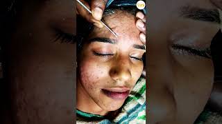 The Ultimate Blackhead Hack 😱 skincare glowingskin diy beautytips trending [upl. by Arymat]