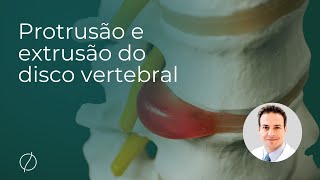 Protrusão e extrusão do disco vertebral quais são as diferenças [upl. by Htebasyle]