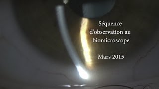 Biomicroscope  17 étapes dobservation [upl. by Tallu]