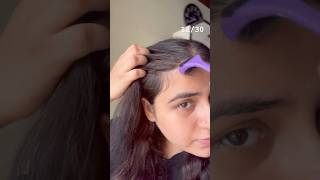 ✅hair fall solution hair hairgoals hairgrowth haircare [upl. by Izaak6]