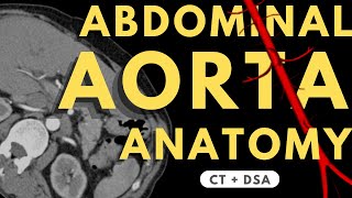 Abdominal Aorta and Branches  Radiology anatomy part 1 prep  How to read CTA  DSA [upl. by Mccully]