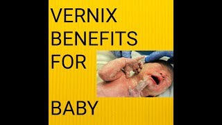 BENEFITS OF VERNIX TO YOUR NEW BORN BABY [upl. by Viglione861]