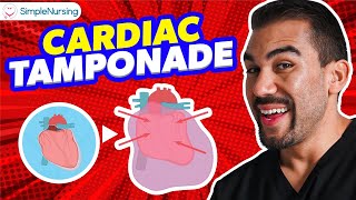 Cardiac Tamponade NCLEX Tips for Nursing Students [upl. by Aseneg34]