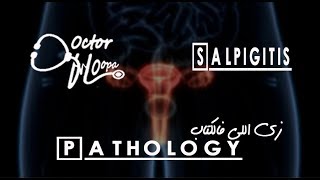 Salpingitis  Pathology زي اللي فالكتاب  Doctor HOopa [upl. by Chong]