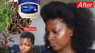 Wow 😮 Mix Vaseline with Cloves amp Rosemary and Grow Hair like never before [upl. by Notgnillew]