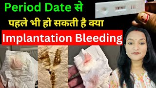 Kiya Period date se pahle bhi ho skati hai Implantation Bleeding Implantation Bleeding kab hoti hai [upl. by Yenettirb]