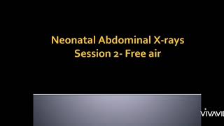 Neonatal abdominal Xrays free air [upl. by Araz]