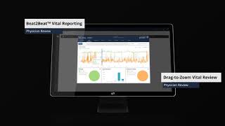 Connect communicate track and report on all patient monitoring [upl. by Llevert181]