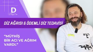 💡 Diz Ağrısı amp Ödemli Diz Tedavisi ➡️ Prolozon Tedavisi [upl. by Adnoved]