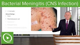 Bacterial Meningitis CNS Infection – Infectious Diseases  Lecturio [upl. by Aldercy]