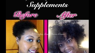 It works Hair Skin and Nails Review with before and after pictures [upl. by Benenson]