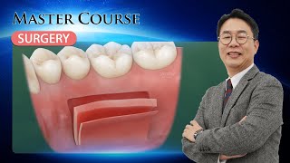 Master Course  SURGERY How to Successfully Master FGG and CTG Procedures [upl. by Mcleod]