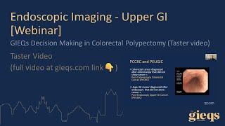 GIEQs Decision Making in Colorectal Polypectomy Taster video [upl. by Anicul]