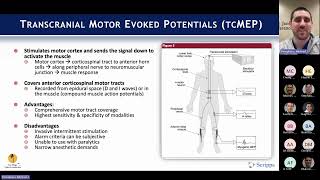 Intraoperative Neuromonitoring with Michael Pompliano MD on March 4 2024 [upl. by Meda]